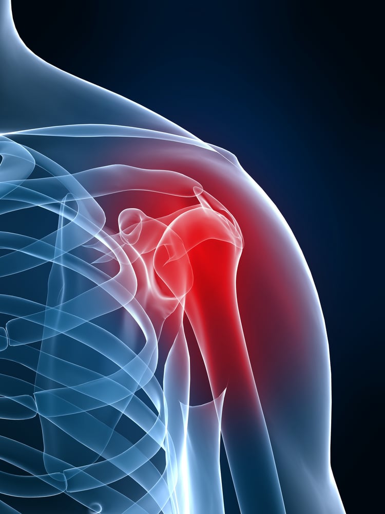 Nevada Workers' Compensation For Shoulder And Neck Injuries